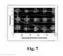 Fig. 08 - Reduced specific absorption ratio T-weighted MRI