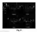 Fig. 09 - Reduced specific absorption ratio T-weighted MRI