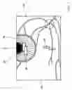 Fig. 04 - System to facilitate alignment and focussing of a fundus camera
