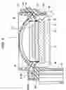 Fig. 04 - Pot type yoke, speaker apparatus and method of manufacturing pot type yoke