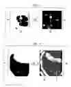 Fig. 04 - System and method for filtering a medical image