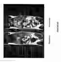 Fig. 07 - Poly (L-glutamic acid) paramagnetic material complex and use as a biodegradable MRI contrast agent