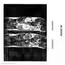 Fig. 08 - Poly (L-glutamic acid) paramagnetic material complex and use as a biodegradable MRI contrast agent