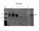 Fig. 06 - Agents and compositions and methods utilizing same useful in diagnosing and/or treating or preventing plaque forming diseases