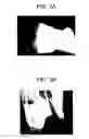 Fig. 04 - Matrix composition for human grafts/implants