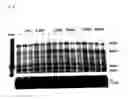 Fig. 11 - Compositions and methods for ligament growth and repair