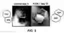 Fig. 07 - Methods and materials for the inhibition of transplant rejection