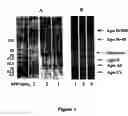 Fig. 02 - Compositions and methods for apo-b48 and apo-b100 assay