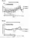 Fig. 05 - Methods for the therapy of Inflammatory Bowel Disease using a type-1 interferon antagonist