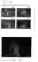Fig. 34 - Mouse prostate stem cell antigen and uses thereof