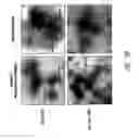 Fig. 08 - Measles subunit vaccine