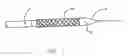 Fig. 02 - Endoprostheses and methods of manufacture