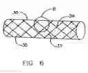 Fig. 07 - Endoprostheses and methods of manufacture