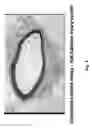 Fig. 09 - Soft tissue implants and anti-scarring agents