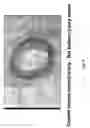 Fig. 10 - Soft tissue implants and anti-scarring agents