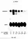 Fig. 16 - Soft tissue implants and anti-scarring agents