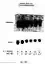 Fig. 20 - Soft tissue implants and anti-scarring agents