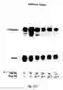 Fig. 22 - Soft tissue implants and anti-scarring agents