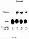 Fig. 23 - Soft tissue implants and anti-scarring agents