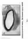 Fig. 09 - Soft tissue implants and anti-scarring agents