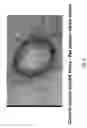 Fig. 10 - Soft tissue implants and anti-scarring agents