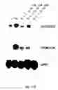 Fig. 15 - Soft tissue implants and anti-scarring agents