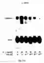 Fig. 16 - Soft tissue implants and anti-scarring agents