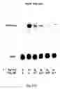 Fig. 19 - Soft tissue implants and anti-scarring agents