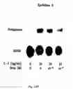 Fig. 23 - Soft tissue implants and anti-scarring agents