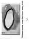 Fig. 09 - Soft tissue implants and anti-scarring agents