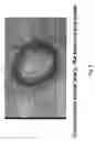 Fig. 10 - Soft tissue implants and anti-scarring agents