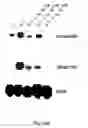 Fig. 15 - Soft tissue implants and anti-scarring agents