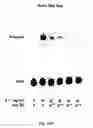 Fig. 19 - Soft tissue implants and anti-scarring agents
