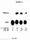 Fig. 23 - Soft tissue implants and anti-scarring agents
