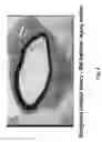 Fig. 09 - Soft tissue implants and anti-scarring agents
