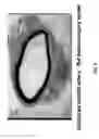 Fig. 09 - Soft tissue implants and anti-scarring agents