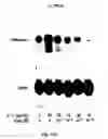 Fig. 16 - Soft tissue implants and anti-scarring agents