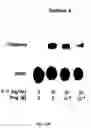 Fig. 23 - Soft tissue implants and anti-scarring agents