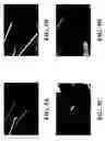 Fig. 07 - Transplantable particulate bone composition having high osteoinductive capacity and methods for making and using same