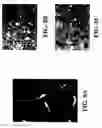Fig. 10 - Transplantable particulate bone composition having high osteoinductive capacity and methods for making and using same
