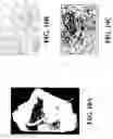 Fig. 12 - Transplantable particulate bone composition having high osteoinductive capacity and methods for making and using same