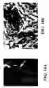Fig. 16 - Transplantable particulate bone composition having high osteoinductive capacity and methods for making and using same