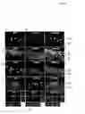 Fig. 10 - Methods and compositions for promoting axon regeneration and cell replacement therapy