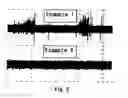 Fig. 06 - Perpendicular magnetic recording medium and a method for manufacturing the same