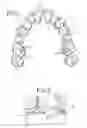 Fig. 02 - Three-dimensional occlusal and interproximal contact detection and display using virtual tooth models