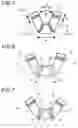 Fig. 04 - Adjustable impression tray with variable geometry