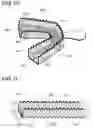 Fig. 06 - Adjustable impression tray with variable geometry