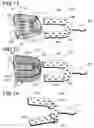Fig. 07 - Adjustable impression tray with variable geometry