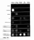 Fig. 19 - Method and devices for running reactions on a target plate for MALDI mass spectrometry