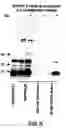 Fig. 06 - Compositions and method for regulation of calcium-dependent signaling in brain